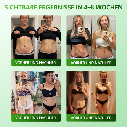 𝐋𝒐𝐭𝗺𝗮𝐲® 𝗬𝗼𝘂𝐭𝐡𝐆𝗹𝗼𝘄 𝑺𝒕𝙖𝙢𝙢𝙯𝙚𝒍𝒍𝒆𝒏👑 𝙆𝙤𝒍𝒍𝒂𝙜𝙚𝒏 𝗧𝗿𝗼𝒑𝐟𝙚𝙣 (𝗦𝘁𝗿𝗮𝗳𝗳𝘁 𝘂𝗻𝗱 𝗳𝗲𝘀𝘁𝗶𝗴𝘁 𝘀𝗰𝗵𝗹𝗮𝗳𝗳𝗲 𝗛𝗮𝘂𝘁, 𝗿𝗲𝗱𝘂𝘇𝗶𝗲𝗿𝘁 𝗙𝗮𝗹𝘁𝗲𝗻𝗯𝗶𝗹𝗱𝘂𝗻𝗴 𝘂𝗻𝗱 𝗳ö𝗿𝗱𝗲𝗿𝘁 𝗛𝗮𝗮𝗿𝘄𝗮𝗰𝗵𝘀𝘁𝘂𝗺 𝘂𝗻𝗱 𝗴𝗲𝘀𝘂𝗻𝗱𝗲 𝗡ä𝗴𝗲𝗹) 🍃