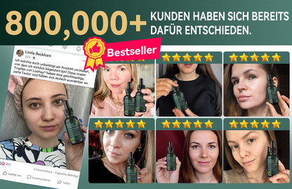 𝐋𝒐𝐭𝗺𝗮𝐲® 𝗬𝗼𝘂𝐭𝐡𝐆𝗹𝗼𝘄 𝑺𝒕𝙖𝙢𝙢𝙯𝙚𝒍𝒍𝒆𝒏👑 𝙆𝙤𝒍𝒍𝒂𝙜𝙚𝒏 𝗧𝗿𝗼𝒑𝐟𝙚𝙣 (𝗦𝘁𝗿𝗮𝗳𝗳𝘁 𝘂𝗻𝗱 𝗳𝗲𝘀𝘁𝗶𝗴𝘁 𝘀𝗰𝗵𝗹𝗮𝗳𝗳𝗲 𝗛𝗮𝘂𝘁, 𝗿𝗲𝗱𝘂𝘇𝗶𝗲𝗿𝘁 𝗙𝗮𝗹𝘁𝗲𝗻𝗯𝗶𝗹𝗱𝘂𝗻𝗴 𝘂𝗻𝗱 𝗳ö𝗿𝗱𝗲𝗿𝘁 𝗛𝗮𝗮𝗿𝘄𝗮𝗰𝗵𝘀𝘁𝘂𝗺 𝘂𝗻𝗱 𝗴𝗲𝘀𝘂𝗻𝗱𝗲 𝗡ä𝗴𝗲𝗹) 🍃