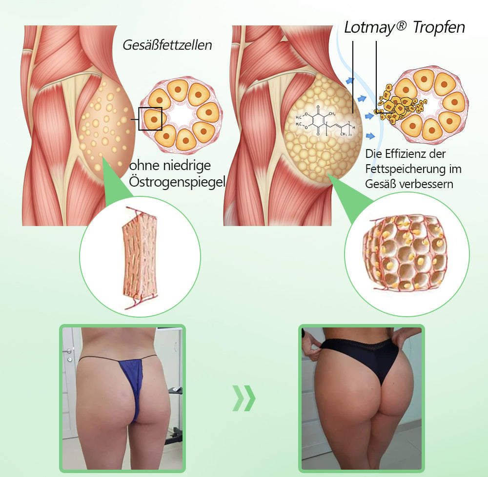 𝐋𝒐𝐭𝗺𝗮𝐲® 𝗬𝗼𝘂𝐭𝐡𝐆𝗹𝗼𝘄 𝑺𝒕𝙖𝙢𝙢𝙯𝙚𝒍𝒍𝒆𝒏👑 𝙆𝙤𝒍𝒍𝒂𝙜𝙚𝒏 𝗧𝗿𝗼𝒑𝐟𝙚𝙣 (𝗦𝘁𝗿𝗮𝗳𝗳𝘁 𝘂𝗻𝗱 𝗳𝗲𝘀𝘁𝗶𝗴𝘁 𝘀𝗰𝗵𝗹𝗮𝗳𝗳𝗲 𝗛𝗮𝘂𝘁, 𝗿𝗲𝗱𝘂𝘇𝗶𝗲𝗿𝘁 𝗙𝗮𝗹𝘁𝗲𝗻𝗯𝗶𝗹𝗱𝘂𝗻𝗴 𝘂𝗻𝗱 𝗳ö𝗿𝗱𝗲𝗿𝘁 𝗛𝗮𝗮𝗿𝘄𝗮𝗰𝗵𝘀𝘁𝘂𝗺 𝘂𝗻𝗱 𝗴𝗲𝘀𝘂𝗻𝗱𝗲 𝗡ä𝗴𝗲𝗹) 🍃