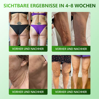 𝐋𝒐𝐭𝗺𝗮𝐲® 𝗬𝗼𝘂𝐭𝐡𝐆𝗹𝗼𝘄 𝑺𝒕𝙖𝙢𝙢𝙯𝙚𝒍𝒍𝒆𝒏👑 𝙆𝙤𝒍𝒍𝒂𝙜𝙚𝒏 𝗧𝗿𝗼𝒑𝐟𝙚𝙣 (𝗦𝘁𝗿𝗮𝗳𝗳𝘁 𝘂𝗻𝗱 𝗳𝗲𝘀𝘁𝗶𝗴𝘁 𝘀𝗰𝗵𝗹𝗮𝗳𝗳𝗲 𝗛𝗮𝘂𝘁, 𝗿𝗲𝗱𝘂𝘇𝗶𝗲𝗿𝘁 𝗙𝗮𝗹𝘁𝗲𝗻𝗯𝗶𝗹𝗱𝘂𝗻𝗴 𝘂𝗻𝗱 𝗳ö𝗿𝗱𝗲𝗿𝘁 𝗛𝗮𝗮𝗿𝘄𝗮𝗰𝗵𝘀𝘁𝘂𝗺 𝘂𝗻𝗱 𝗴𝗲𝘀𝘂𝗻𝗱𝗲 𝗡ä𝗴𝗲𝗹) 🍃